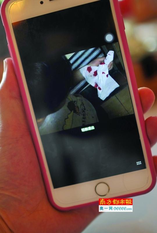 廣東一幼兒園多名孩子流鼻血 園方稱去年更換跑道