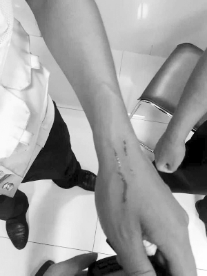 民警的手被抓傷